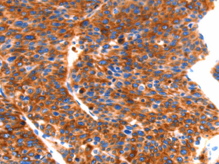 SEPT4 Polyclonal Antibody Store at -20°C - Biomarkers - Elabscience Biotechnology - MSE Supplies