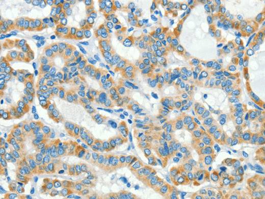 L1CAM Polyclonal Antibody Store at -20°C