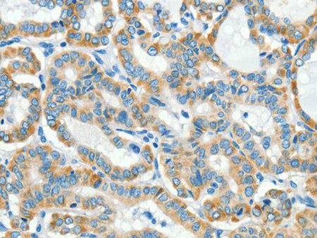 L1CAM Polyclonal Antibody Store at -20°C
