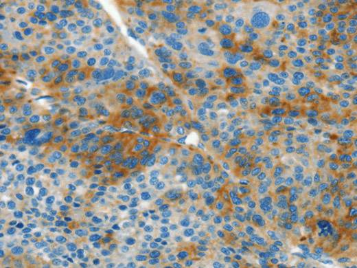 L1CAM Polyclonal Antibody Store at -20°C