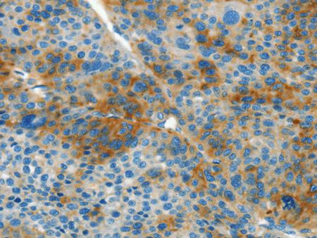 L1CAM Polyclonal Antibody Store at -20°C