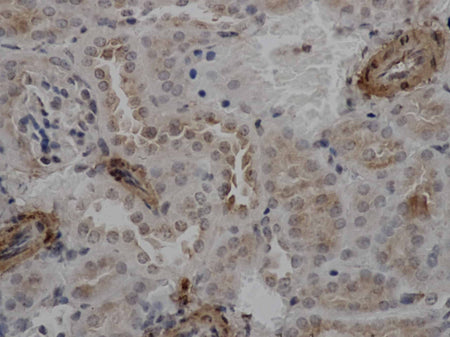 ACTA2 Polyclonal Antibody Store at -20°C