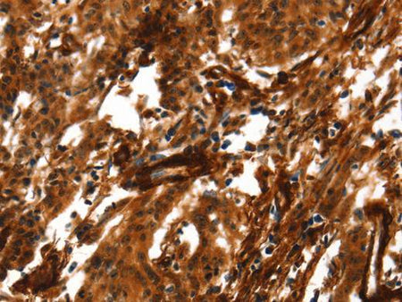 ACTA2 Polyclonal Antibody Store at -20°C