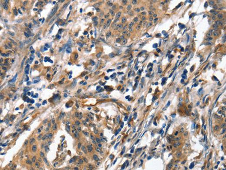 ALOX15 Polyclonal Antibody