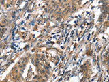 ALOX15 Polyclonal Antibody