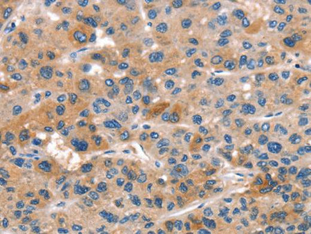 ALOX15 Polyclonal Antibody
