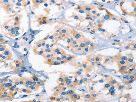 AHR Polyclonal Antibody Store at -20°C Host Rabbit