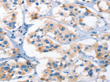AHR Polyclonal Antibody Store at -20°C Host Rabbit
