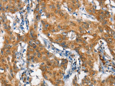 STAT2 Polyclonal Antibody Store at -20°C