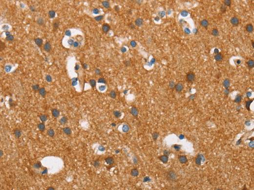 COX5A Polyclonal Antibody Store at -20°C