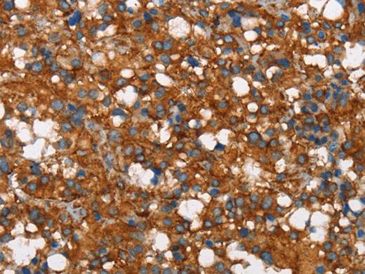 COX5A Polyclonal Antibody Store at -20°C