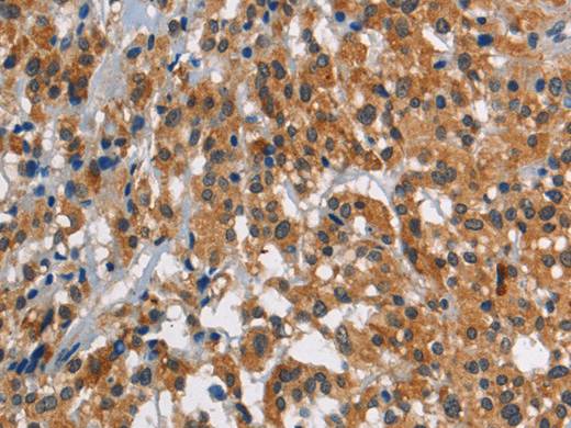 SMAD9 Polyclonal Antibody Store at -20°C Host Rabbit