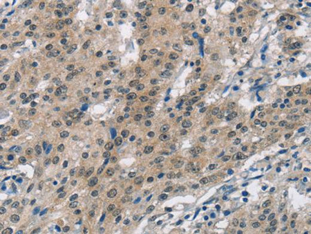SMAD9 Polyclonal Antibody Store at -20°C Host Rabbit