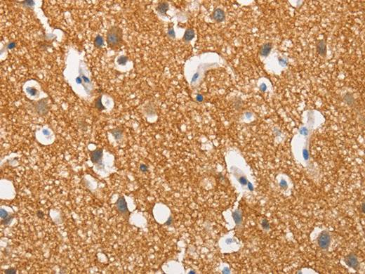 SNCA Polyclonal Antibody Store at -20°C Host Rabbit