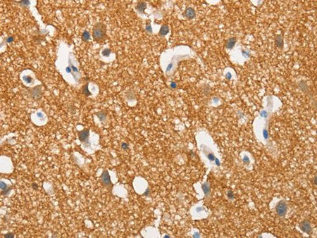 SNCA Polyclonal Antibody Store at -20°C Host Rabbit