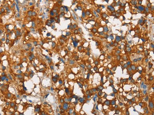 SNCA Polyclonal Antibody Store at -20°C Host Rabbit