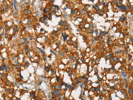 SNCA Polyclonal Antibody Store at -20°C Host Rabbit