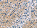 MCL1 Polyclonal Antibody Store at -20°C Host Rabbit