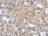 MCL1 Polyclonal Antibody Store at -20°C Host Rabbit