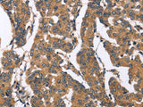 BNIP2 Polyclonal Antibody