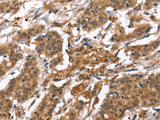 BNIP2 Polyclonal Antibody