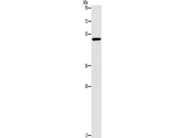 PLIN2 Polyclonal Antibody