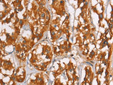 PLIN2 Polyclonal Antibody