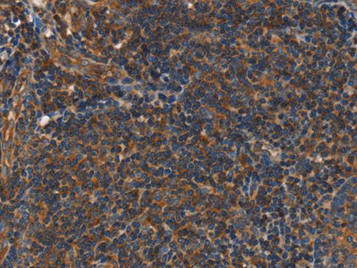 PLIN2 Polyclonal Antibody