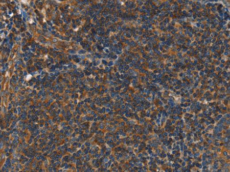 PLIN2 Polyclonal Antibody