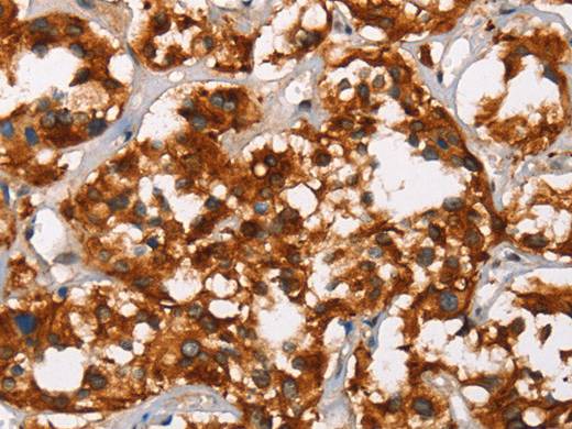 ADNP Polyclonal Antibody Store at -20°C
