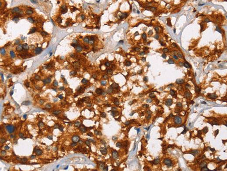 ADNP Polyclonal Antibody Store at -20°C