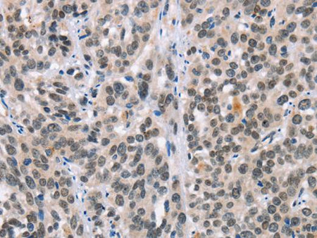 ADNP Polyclonal Antibody Store at -20°C
