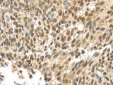 APOL6 Polyclonal Antibody