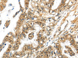 APOL6 Polyclonal Antibody