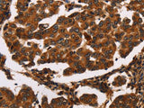 ARSB Polyclonal Antibody