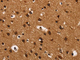 ARSB Polyclonal Antibody