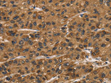 ATP7A Polyclonal Antibody Store at -20°C