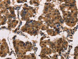 ATP7A Polyclonal Antibody Store at -20°C