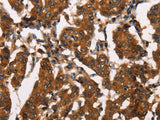 ATRN Polyclonal Antibody