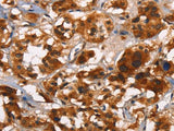 ATRN Polyclonal Antibody