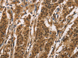 ADGRB1 Polyclonal Antibody