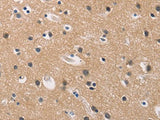 ADGRB1 Polyclonal Antibody