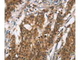 BCAS4 Polyclonal Antibody