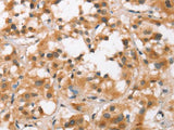 BCAS4 Polyclonal Antibody