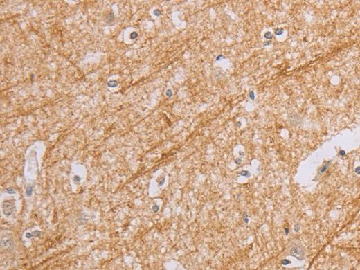BGLAP Polyclonal Antibody Store at -20°C Host Rabbit