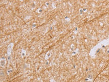 BGLAP Polyclonal Antibody Store at -20°C Host Rabbit
