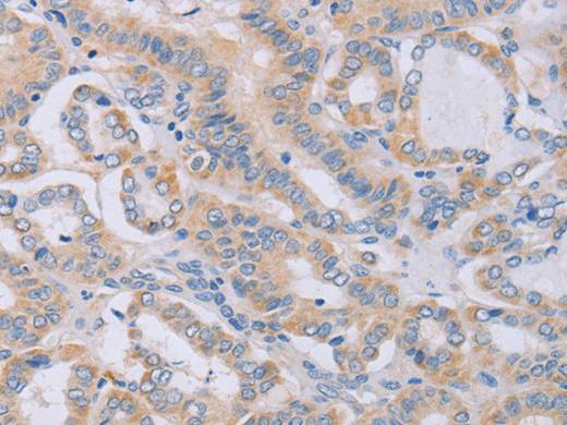 BGLAP Polyclonal Antibody Store at -20°C Host Rabbit