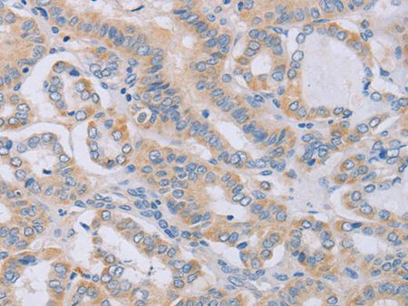 BGLAP Polyclonal Antibody Store at -20°C Host Rabbit