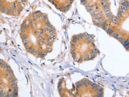 BLNK Polyclonal Antibody Store at -20°C Host Rabbit