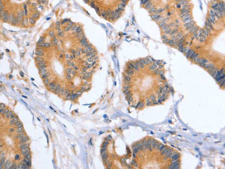 BLNK Polyclonal Antibody Store at -20°C Host Rabbit